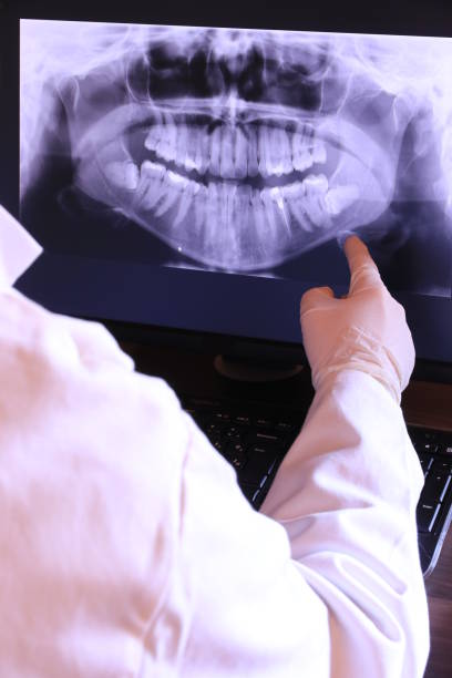 Best Emergency Dental Care for Abscessed Tooth in Lake Placid, NY