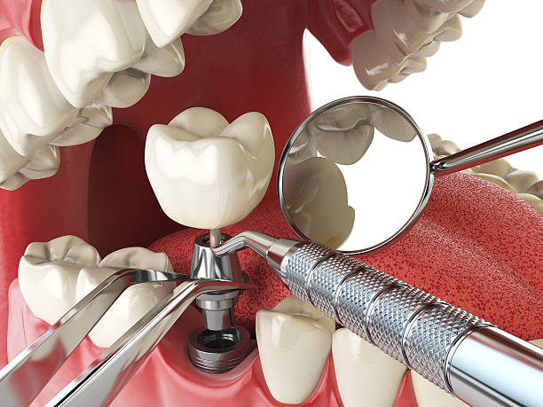 Best Emergency Dentist for Special Needs Patients in Lake Placid, NY
