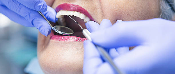 Best Emergency Dentist for Lost Fillings or Crowns in Lake Placid, NY